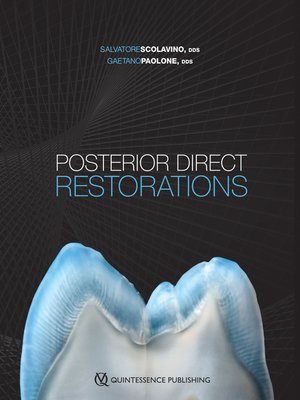 cover image of Posterior Direct Restorations